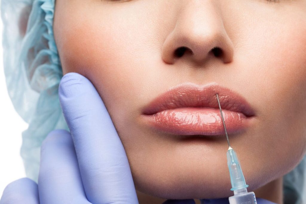 Hyaluronzuur fillers
